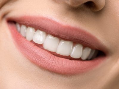 Tooth Whitening Smile